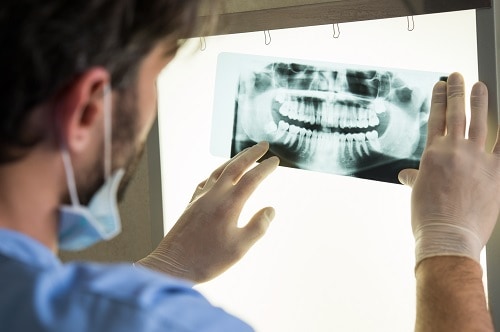 Understanding Dental X-Rays