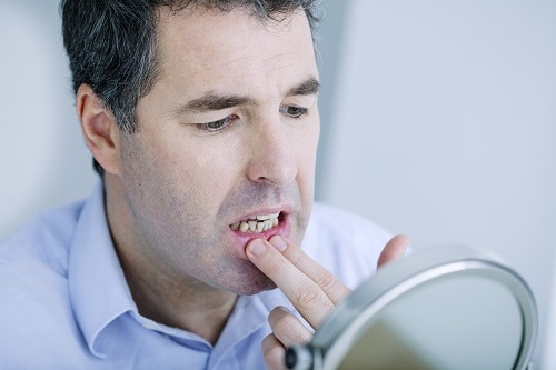 4 Causes of Gum Pain